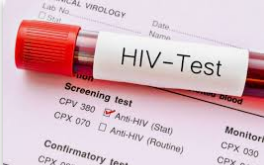 Tập huấn tư vấn xét nghiệm HIV cho cán bộ Y tế năm 2018